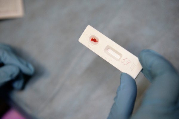 Ученые США увидели, как ВИЧ атакует и проникает в человеческие клетки